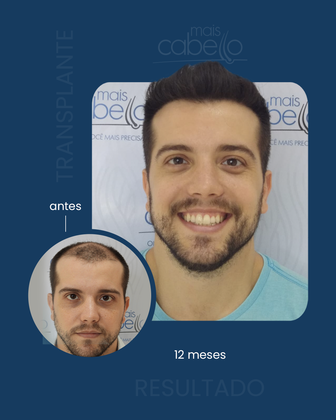 Antes e depois Mais Cabello