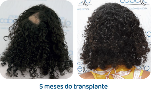 Antes e Depois - Caso Real