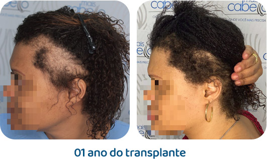 Antes e Depois - Caso Real